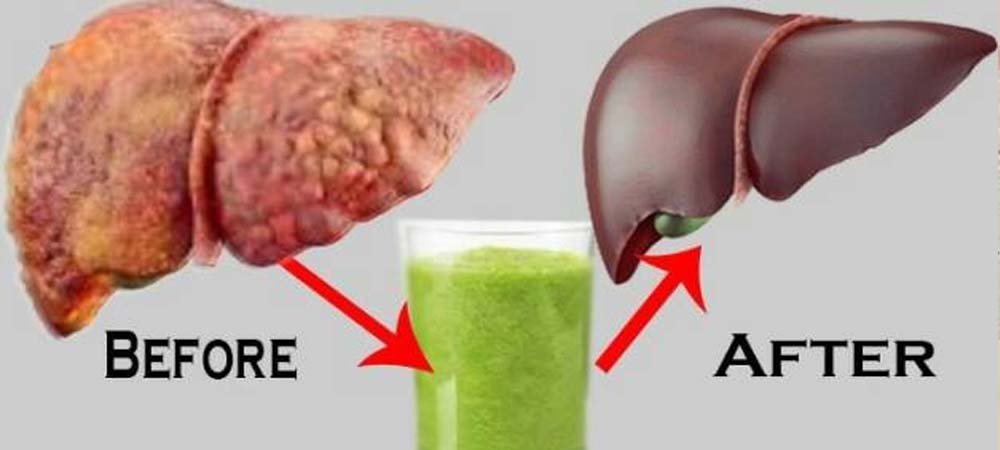 This successful recipe will remove all the dirt in your liver