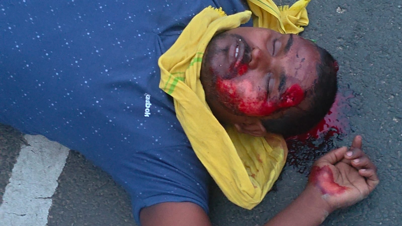 सड़क दुर्घटना में बाइक सवार एक युवक घायल,रेफर।