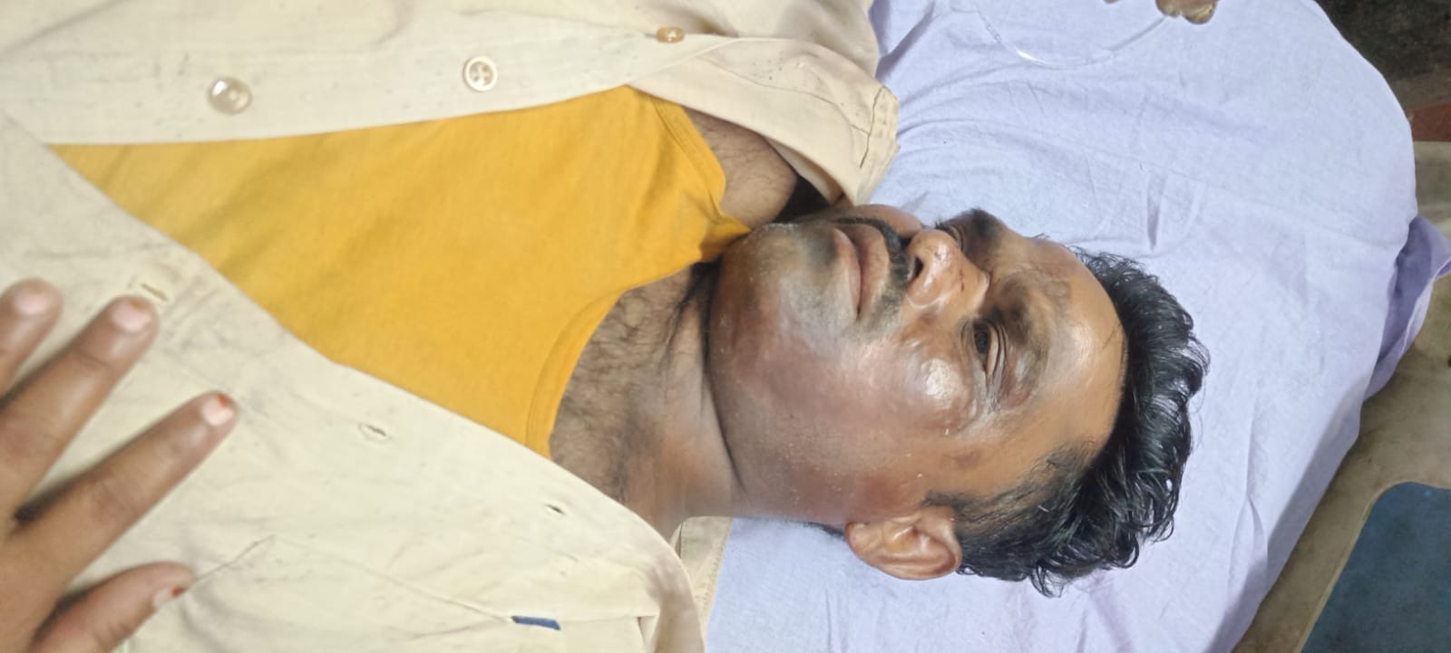 मोटरसाइकिल से गिरकर पिता-पुत्र जख्मी।