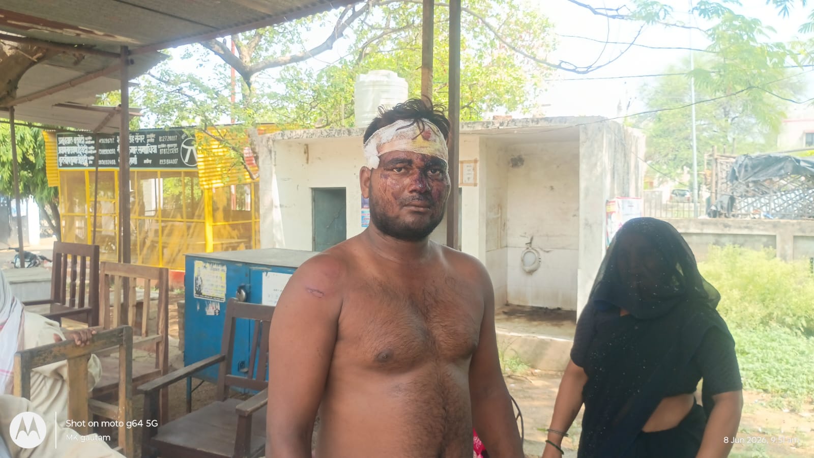 मामूली विवाद में युवक को बेरहमी से पीटा, लहूलुहान हालत में क्षेत्राधिकारी कार्यालय पहुंचकर लगाई न्याय की गुहार