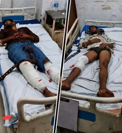गुरुआ ज्वेलरी लूटकांड में शामिल दो बदमाश पुलिस मुठभेड़ में घायल, गिरफ्तार