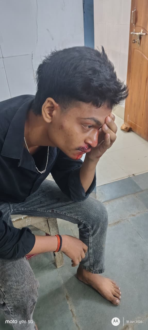 लोहा पुल के समीप दो बाइकों की आमने-सामने टक्कर, तीन युवक घायल