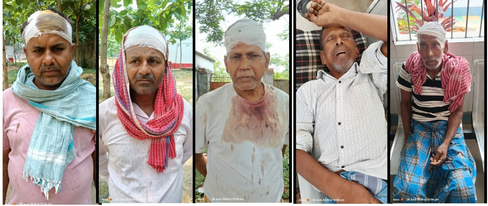मारपीट की घटना में आधा दर्जन लोग घायल,एक दर्जन से अधिक लोगों पर एफआईआर दर्ज।