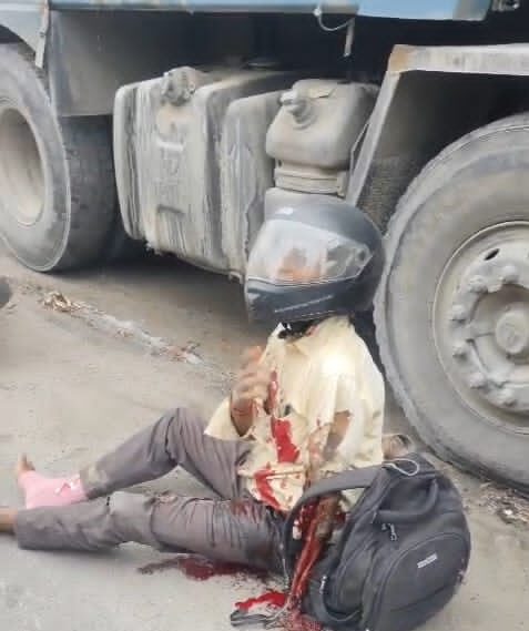 चतरा में जर्जर सड़क के कारण बड़ा हादसा, बाइक सवार को हाइवा ने कुचला, हालत गंभीर