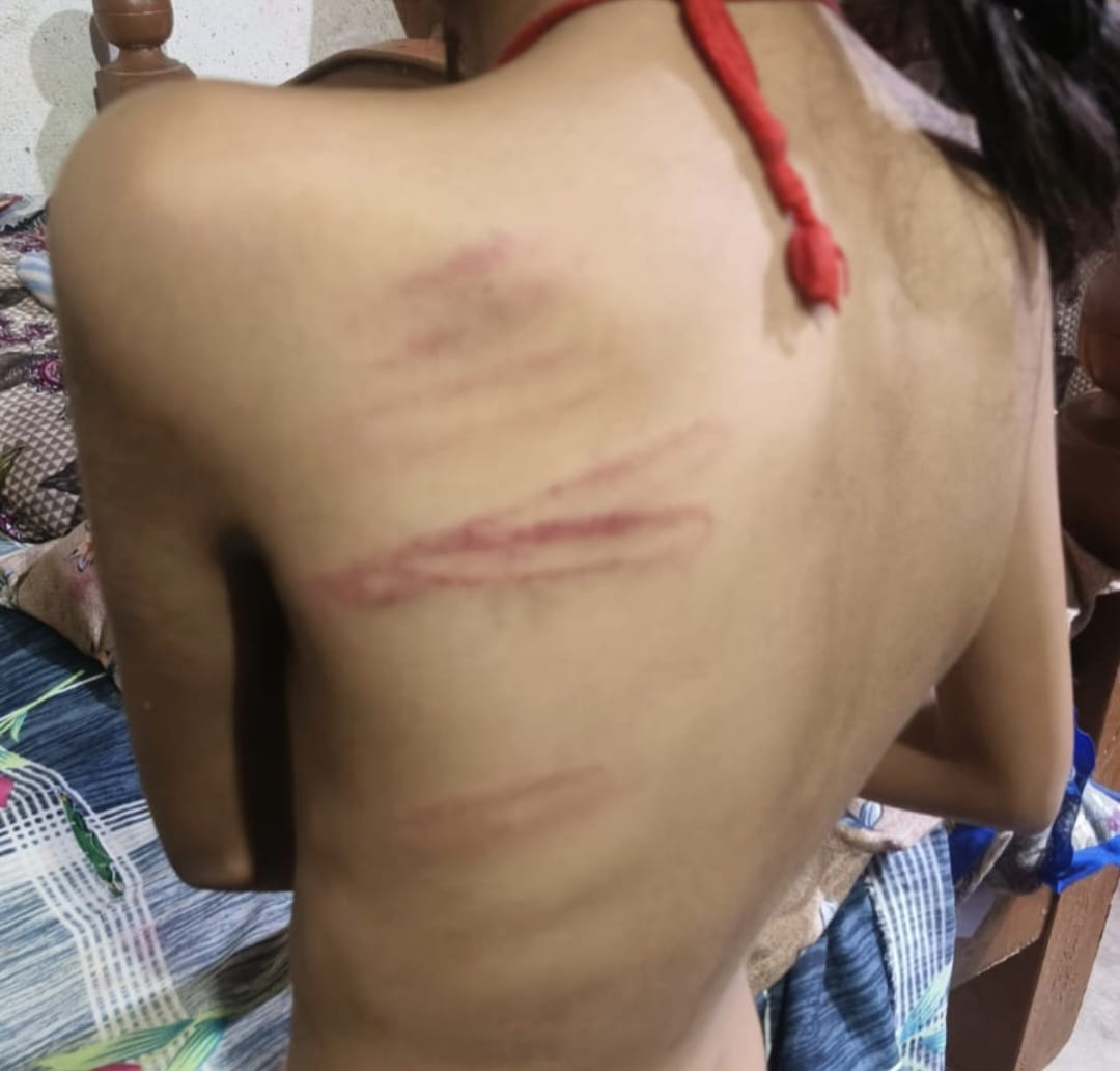 छात्रा को बेरहमी पीटने वाले आरोपी शिक्षक मनीष कुमार सस्पेंड, विभागीय जांच के आदेश