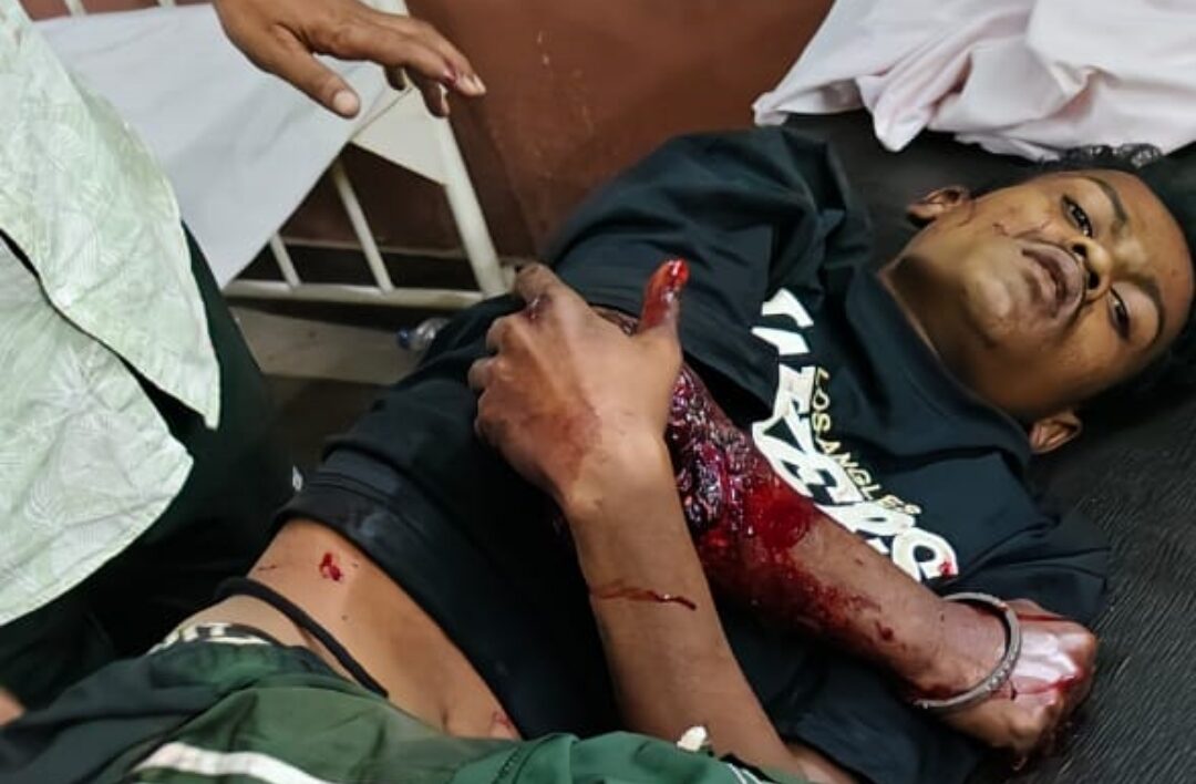 कार और मोटरसाइकिल की टक्कर में बहन की मौत, भाई घायल