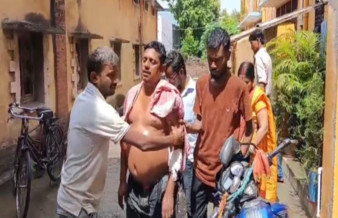 कांवरिया के वेश में युवक ने कैंची से किया हमला, तीन दुकानदार घायल