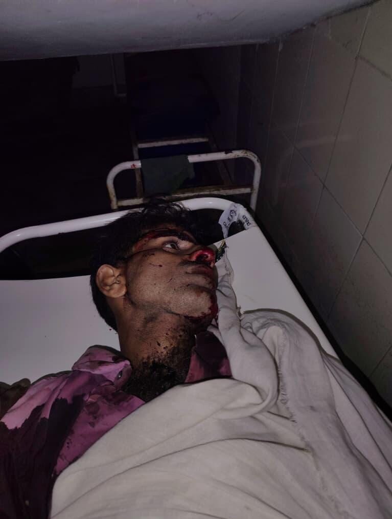 मेड़ना में अज्ञात वाहन की टक्कर से बाइक सवार युवक की मौत, दो घायल