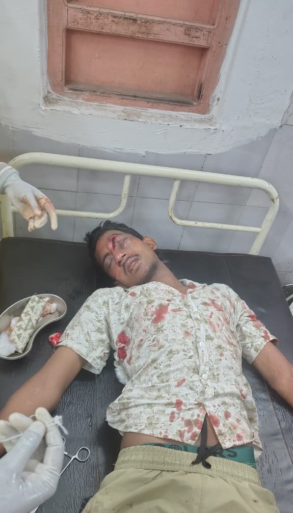 तेज रफ्तार बाइक ने एक व्यक्ति को मारी टक्कर, दोनों गंभीर रूप से घायल