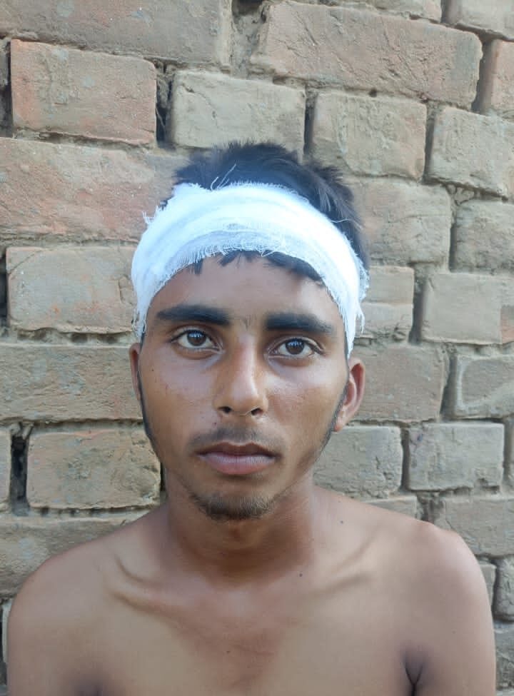 मवेशी को साइड करने के विवाद में भिड़े मवेशी पालक और CNG चालक, दो घायल