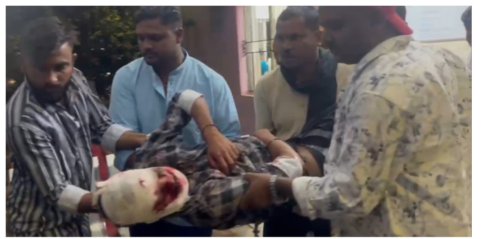 इटखोरी के करनी गांव में मोटरसाइकिल और ऑटो की जोरदार टक्कर, दो युवक गंभीर रूप से घायल, रेफर