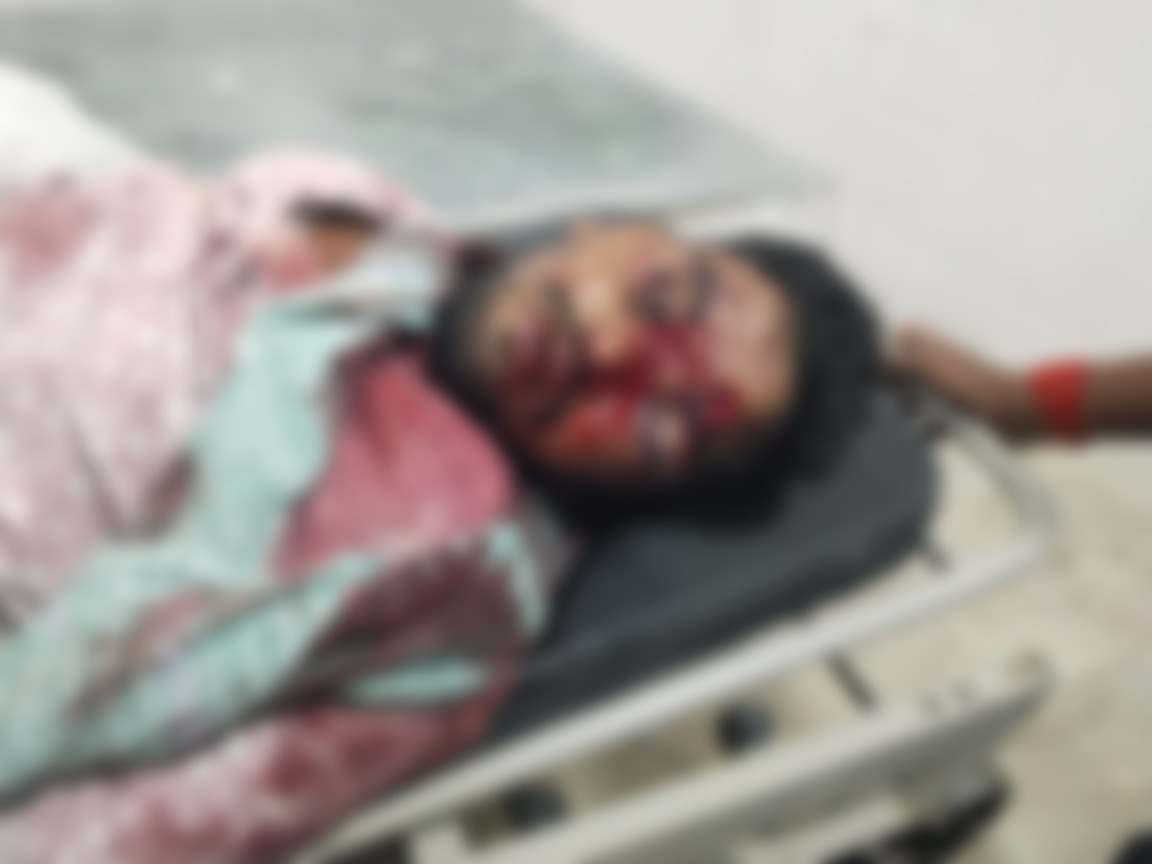 कान्हाचट्टी में सड़क हादसा, अज्ञात वाहन की चपेट में आने से युवक की मौत